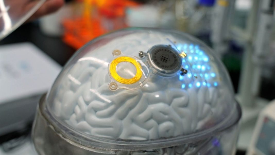 China faz primeiro implante cerebral para uso comercial do mundo China faz primeiro implante cerebral para uso comercial do mundo