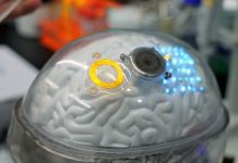 China faz primeiro implante cerebral para uso comercial do mundo China faz primeiro implante cerebral para uso comercial do mundo